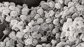 Elektronenmikroskopische Aufnahme eines Zell-Aggregats von Comammox-Bakterien der Art Nitrospira inopinata. Die Zellen haben einen Durchmesser von etwa 0,3 Mikrometer und sind bis zu 1,7 Mikrometer lang. (Anne Daebeler und Stefano Romano, Universität Wien)