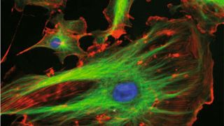 Abb. 1: Fluoreszenzmikroskopische Aufnahme einer Zelle.  (Bild: wikipedia.org)