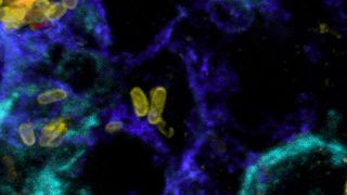 Abb. 1: Von Salmonellen befallene Zellen (Makrophagen blau, Monozyten türkis), abgestorbene Salmonellen (nur gelb) und lebende Salmonellen (gelb und rot). (Bild: Universität Basel, Biozentrum)
