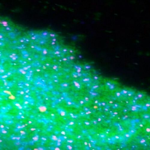 Fluorescence image of a Caulobacter biofilm. Live cells are labelled in green, dead ones in pink, and extracellular DNA release during cell death is shown in blue.