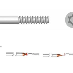 1 - Tournage avant TOPDEC VCGX-FN	 2 - Filetage TURNDEC G6-R 3 - Tronçonnage TURNDEC A6-R	 4 - Pré-perçage Torx® solution  5 - Fraisage Torx Torx® solution	 6 - Ébavurer Torx® solution (Source :  Diametal)
