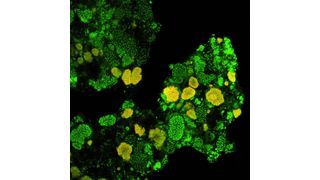 1		Nachweis der Mikrokolonien von Nitrospira (gelb) sowie anderer Bakterien (grün) in Klärschlamm mittels Fluoreszenz-in-situ-Hybridisierung (Bilder: Universität Wien, Department für mikrobielle Ökologie). (Archiv: Vogel Business Media)