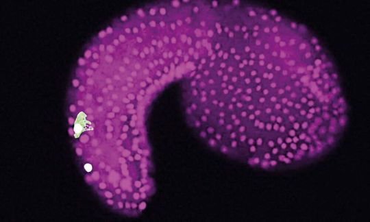 Ein Embryo des Manteltiers Ciona intestinalis mit „Bipolar Tail Neurons“ (Grün) und Zellen der Epidermis (Magenta). Ein Embryo des Manteltiers Ciona intestinalis mit „Bipolar Tail Neurons“ (Grün) und Zellen der Epidermis (Magenta).