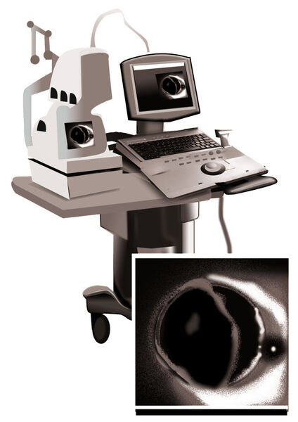Bild 1: OCT-Instrumente werden heute schon erfolgreich in der Augenheilkunde eingesetzt (Bild: Texas Instruments)