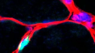 Skelettmuskulatur: Die Kerne der Muskelstammzellen sind in grün zu sehen. Die Zellkerne der Muskelfasern sind in blau, die Umgrenzung um die Muskelfasern (Basallamina) ist rot. Maßstab: 20µm. (AG Carmen Birchmeier / MDC)