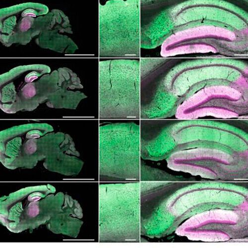Changes in the entire brain (left) and hippocampus (middle) are evident in these images shot during the course of a mouse's life. Green shows the protein PSD95 and cyan is the protein SAP102. Changes in the entire brain (left) and hippocampus (middle) are evident in these images shot during the course of a mouse's life. Green shows the protein PSD95 and cyan is the protein SAP102.