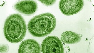 Elektronenmikroskopische Aufnahme von Prochlorococcus marinus (Bild: Luke Thompson from Chisholm Lab and Nikki Watson from Whitehead, MIT – CC0)