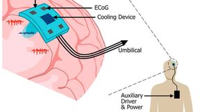 Der Prototyp kombiniert ECoG-Aufzeichnung mit fokaler Hirnkühlung. Seine 3D-gedruckte Silikonstruktur enthält fluidische Kanäle und ist mit diskreten elektronischen Komponenten bestückt. (Bild:  Moore et al. (2026))