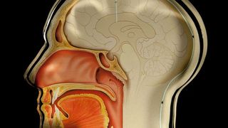 Mithilfe eines implantierten Überwachungssensors können Mediziner den Hirndruck messen. Sie müssen lediglich ein Handlesegerät an den Kopf des Patienten halten. (Patrick J. Lynch / Fraunhofer IMS)