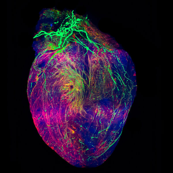 Herz-Atlas in 3D  Das Herz ist das logistische Zentrum unseres Körpers. Es schlägt etwa 100.000-mal pro Tag und pumpt dabei rund 7.200 Liter Blut durch den Körper, um jede Zelle vom Gehirn bis zum kleinen Zeh mit Sauerstoff und lebenswichtigen Nährstoffen zu versorgen. Doch das Herz ist noch immer nicht vollständig verstanden. Besonders die Zusammenarbeit und die 3D-Struktur der verschiedenen Unterarten von Zellen erfordern noch einiges an Forschungsarbeit. Dieser widmet sich der „Nomis Human Heart Atlas“. In dem Projekt wollen Forscher das pulsierende Organ hochauflösend kartieren und mithilfe von Deep-Learning-Algorithmen mehr über dessen Funktionsweise lernen.  Hier gehts zur Originalmeldung Wissenschaftsbild des Tages vom 30.9.2021  (NOMIS Foundation)