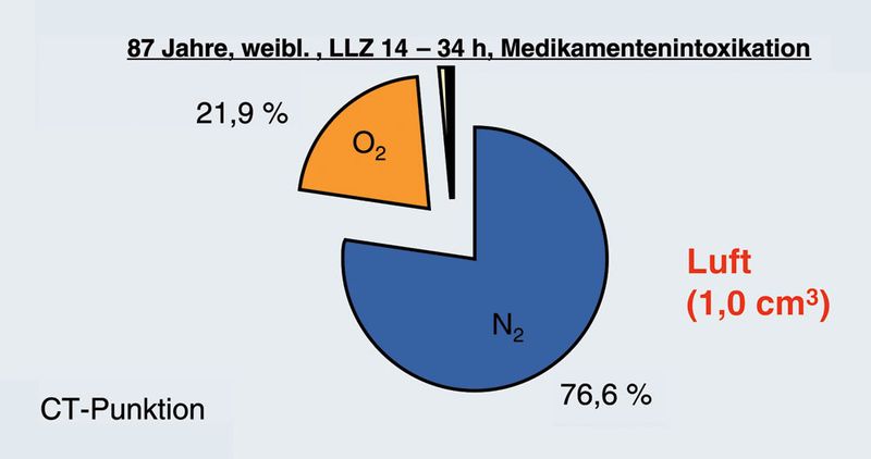 Abb.5: Nachweis von geringer Luftmenge im Pfortadersystem (LLZ = Leichenliegezeit). (Archiv: Vogel Business Media)