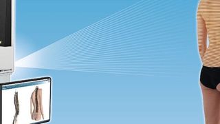 Bei den Vermessungsgeräten Formetric von Diers wirft ein über die Alpha Colonne elektrisch in der Höhe verstellbarer Lichtprojektor ein Linienraster auf den Rücken des Patienten.  (Diers International GmbH)