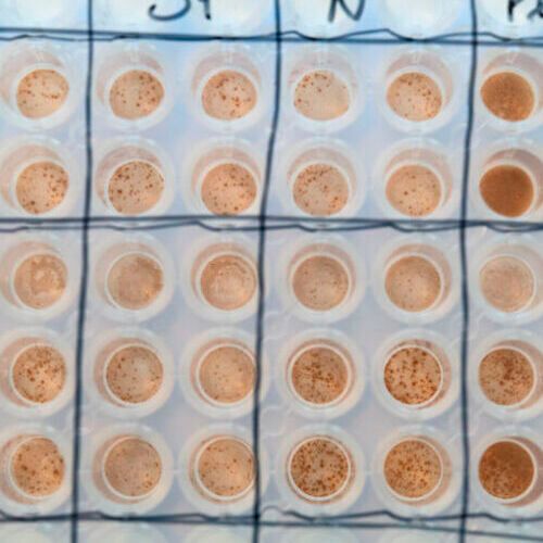 Assay of T cells that recognise the corona virus and can fight the infection. Each spot marks the reaction from a T cell to Sars-Cov-2. Assay of T cells that recognise the corona virus and can fight the infection. Each spot marks the reaction from a T cell to Sars-Cov-2.