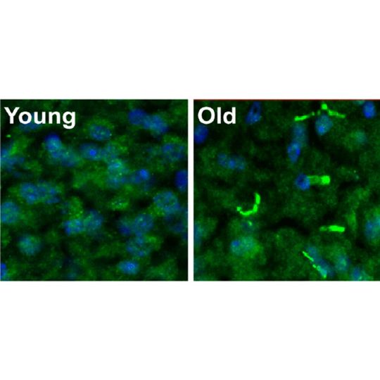 PDE11A memory enzyme (green) in the brains of young (left) and old (right) mice. PDE11A memory enzyme (green) in the brains of young (left) and old (right) mice.