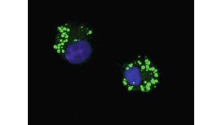 Das Bild zeigt zwei Lymphoid-Zellen (ILC; die Zellkerne sind blau markiert), die in kleinen Fetttröpfchen (lipid droplets, grün) externe Fettsäuren gespeichert haben.  (Bild: © Dr. Fotios Karagiannis/Uni Bonn )