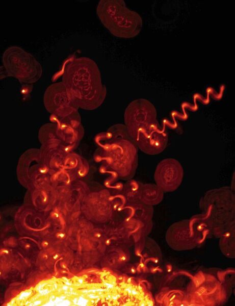 In Gelen, die der Dichte der Säugetierhaut nachempfunden waren, bewegten sich die Malaria-Erreger in Spiralen, erkennbar an den orange leuchtenden „Kriechspuren“ im rund 0,1 Millimeter dicken Polyacrylamid-Gel.  (Universitätsklinikum Heidelberg)