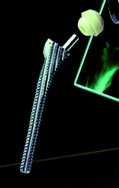 Bild 4: Mit dem Programmier-Zusatzmodul „Medical“ können Medizinalraspeln komfortabel programmiert werden. Bilder: Schütte (Archiv: Vogel Business Media)
