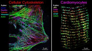 Abb. 1: Fünffach-multiplexierte DNA-PAINT-Super-Resolution-Aufnahme mit automatisiertem mikrofluidischem Lösungswechsel. (Bild: III. Physikalisches Institut Biophysik, Universität Göttingen; Adaptiert nach Basak et al., ACS Nano 20 (2026), unter der Lizenz CC BY 4.0)