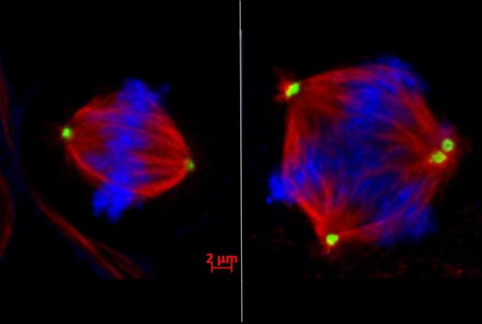 Chromosomen-Chaos Wenn sich normale Zellen teilen, werden die Chromosomen dupliziert und gleichmäßig auf zwei Tochterzellen aufgeteilt. In vielen Krebszellen gerät dieser Prozess jedoch durcheinander, was zu chromosomaler Instabilität führt: zu viele, zu wenige oder durcheinandergebrachte Chromosomen in mehreren Tochterzellen. Der Krebs breitet sich unkontrolliert aus  Ein Behandlungsansatz ist es, die bereits auftretenden Zellteilungsfehler absichtlich zu verstärken, um so den Zelltod der defekten Zelle herbeizuführen. Ein Forscherteam des amerikanischen Sandra and Edward Meyer Cancer Center hat einen neuen therapeutischen Ansatz vorgeschlagen, um Metastasen zu blockieren, bevor sie entstehen. Sie wollen die Ordnung in der Zellteilung wiederherstellen, indem sie ein bestimmtes Enzym blockieren. Denn in ihrer Studie haben die Wissenschaftler gezeigt, dass das Enzym EZH2 eine Schlüsselrolle bei der abnormalen Zellteilung spielt.  Das Bild zeigt links eine normale Zellteilung, bei der die Chromosomen (blau) aufgereiht sind und von den beiden Zentrosomen (grün) in zwei separate Tochterzellen gezogen werden können. Rechts: Bei einer fehlerhaften Zellteilung sind zu viele Zentrosomen vorhanden, was zu mehreren Zellen mit chromosomaler Instabilität führt.   Hier gehts zur Originalmeldung Wissenschaftsbild des Tages vom 7.10.2025   (Bild: Dr. Shelly Yang Bai)