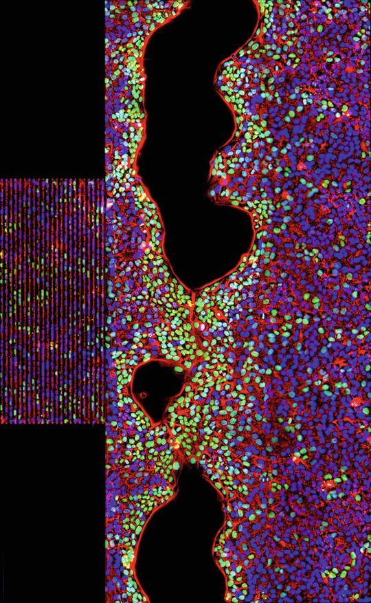 Dreifarbenaufnahme stimulierter Zellen auf einem SAW-Chip. Rot: Phasenkontrastbild der Zellen, blau: Zellkerne, grün: Zellkerne von Zellen, die sich während der Schallbehandlung geteilt haben. Dreifarbenaufnahme stimulierter Zellen auf einem SAW-Chip. Rot: Phasenkontrastbild der Zellen, blau: Zellkerne, grün: Zellkerne von Zellen, die sich während der Schallbehandlung geteilt haben.