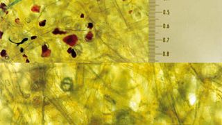 Bild 1: Abgeschiedene Schmutzpartikel eines Hydrauliköls an einer Filtermembran (Filterdauer 1000 h, gezeigte Fläche 1 mm2) bei konventioneller (oben) und Mikrofiltration. (Archiv: Vogel Business Media)