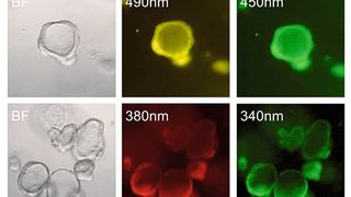 Humane Organoide gezüchtet aus Dünndarmgewebe (Zwölffingerdarm, Duodenum). Transportvorgänge und intrazelluläre Signalprozesse können in Organoiden mittels pH-sensitiven Farbstoffen (obere Reihe) und Calcium-Indikatoren (untere Reihe) sichtbar gemacht und damit auch im Detail erforscht werden. (Bild: E. Rath / TUM)