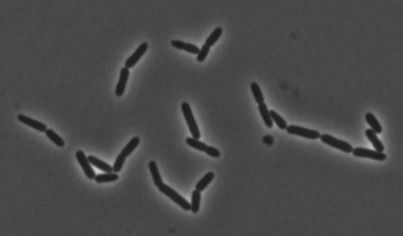 Lactobacillus murinus unter dem Mikroskop (Lisa Maier, EMBL Heidelberg)
