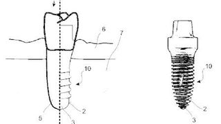 Verfahren zur Behandlung von Oberflächen. (DPMA)