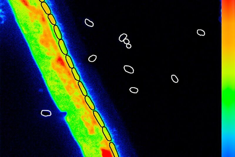 Pilzhyphe und ausgekeimten Zellen des Bakteriums Bacillus subtilis zeigen den Einbau des stabilen Isotops 15N (orange/rot), mit dem die stickstoffhaltigen Nährstoffe markiert wurden. Die ungekeimten Sporen (weiße Kringel) zeigen keine Anreicherung. Aufgenommen wurde das Bild mit einem Sekundärionen-Massenspektrometer. (UFZ)
