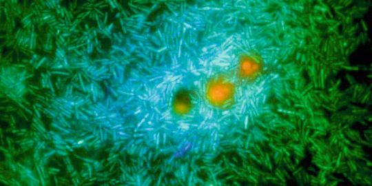 Meeresbakterien (grün und hellblau) ernähren sich von Nährstoffen, die aus einem genetisch veränderten Phytoplankton (orange) austreten. Diese Bakterien setzen eine Substanz frei, die zur Wolkenbildung beiträgt. Meeresbakterien (grün und hellblau) ernähren sich von Nährstoffen, die aus einem genetisch veränderten Phytoplankton (orange) austreten. Diese Bakterien setzen eine Substanz frei, die zur Wolkenbildung beiträgt.