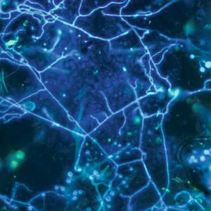 Chytridpilze sind besonders vielseitig und nützlich: Sie befallen zum Beispiel fädige Cyanobakterien, die giftige Algenbl&uuml;ten bilden. Parasitische Pilze töten und "zerhacken" sie und verwandeln sie somit in Nahrung für kleinste wirbellose Tiere. Und Pilze schrecken auch vor schwer abbaubaren Stoffen wie Mikroplastik nicht zurück. Spezielle Enzyme helfen ihnen dabei. (Bild:  Hans-Peter Grossart / IGB)