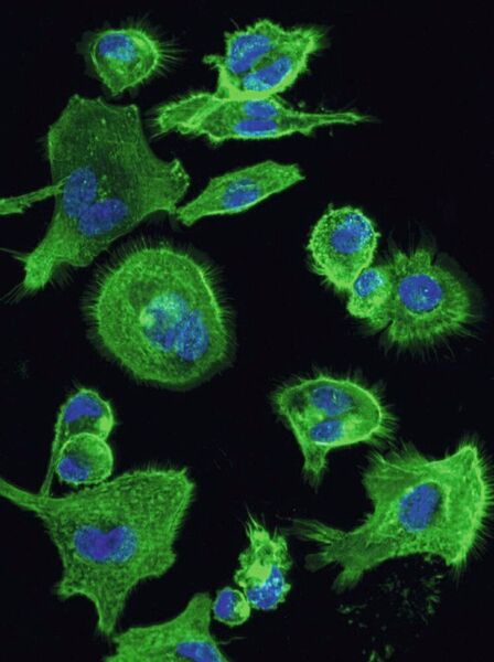 Diese Immunzellen exprimieren den HCA3-Rezeptor, der nur bei Menschanaffen und Menschen vorkommt. Kern und Cytoskelett sind gefärbt. (Claudia Stäubert)