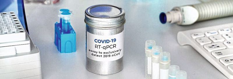 Abb.1: RT-qPCR Tests auf Covid-19 erfordern eine sichere Rückverfolgbarkeit der Probenröhrchen. Abb.1: RT-qPCR Tests auf Covid-19 erfordern eine sichere Rückverfolgbarkeit der Probenröhrchen.