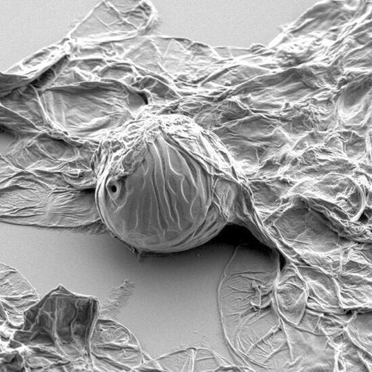 Plant pipe cell reinforced with lignin is highly resistant to negative pressure in contrast to the other flattened cells around. Plant pipe cell reinforced with lignin is highly resistant to negative pressure in contrast to the other flattened cells around.
