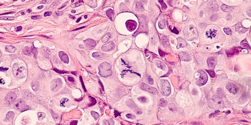Abb. 1: Neu entwickelte lichtaktivierbare Nanopartikel zeigten in biologischen Untersuchungen eine starke Aktivität gegen verschiedene Tumorzelllinien. (Symbolbild)(Bild: ©  David A Litman - stock.adobe.com)