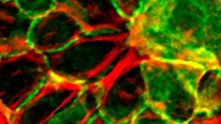 Hautzellen in der Petrischale (grün: Zellskelett, rot: Zell-Zell-Verbindungsprotein). (Ausschnitt) (© MPI f. Biologie des Alterns)