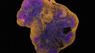 Hirnorganoid, welches nicht mit dem Affenpockenvirus (MPXV) infiziert ist. Die DNA der Zellkerne ist blau gefärbt. Massstab: 1000 μm.  (Bild:  IVI / UniBE)