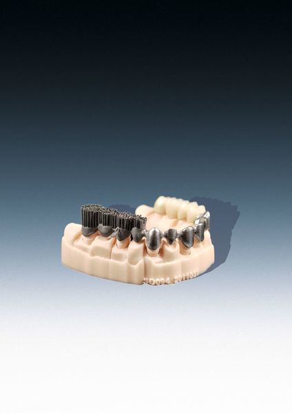 Bild 2: Lasergesinterter Zahnersatz (mit Stützstrukturen; Oberfläche bereit zur Verblendung; nach keramischer Verblendung) auf lasergesintertem Dentalmodell.  (Bild: EOS)