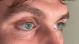 Das künstliche rechte Auge, im Bild links zu sehen, ist kaum vom echten zu unterscheiden: Die mit Technologien des Fraunhofer IGD im 3D-Druckverfahren hergestellten Augenprothesen überzeugen in Erscheinung und Form.  (Bild:  Stephen Bell, Ocupeye Ltd)