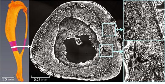 Mäuseknochen: Knochenschnitt unter Laser-Scanning-Mikroskop – vergrößerte Abbildung der dichten Netzwerkarchiktektur und des Flüssigkeitsstroms Mäuseknochen: Knochenschnitt unter Laser-Scanning-Mikroskop – vergrößerte Abbildung der dichten Netzwerkarchiktektur und des Flüssigkeitsstroms