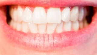 Ob unsere Zähne vom Karies angegriffen werden, hängt nicht nur von der Pflege ab. (gemeinfrei)