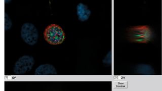 Abb. 1: Blind Deconvolution: Menschliche Drüsenkrebszellen wurden in einem Z-Stapel abgebildet. Nach der Blind Deconvolution nimmt die Unschärfe ab. Außerdem kann der Kontrast gesteigert werden und die Intensität erhöht sich. (Bild: Karl-Heiz Körtje/Leica Microsystems)