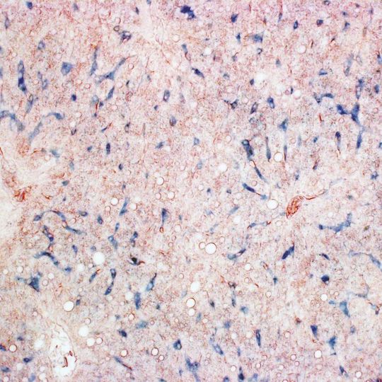 Histologisches Bild von Taubenlebergewebe, das eisenhaltige Makrophagen (blau) zeigt.(Bild:  © Lisowski et al. (2026) Science)