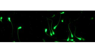 Sample of human spermatozoa (Source: Rita Rahban)