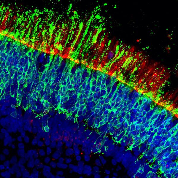 Netzhaut-Organoide zur Erforschung von Alterssehschwäche   Ein Team vom Institut für Molekulare und Klinische Ophthalmologie Basel (IOB) hat gemeinsam mit Kooperationspartnern wichtige medizinische Erkenntnisse aus 20.000 im Labor gezüchteten menschlichen Netzhäuten gewonnen. Die Forscher identifizierten genetische Signalwege und Wirkstoffe, die Zapfen-Photorezeptoren vor Degeneration schützen können, wie sie etwa bei der altersbedingten Makuladegeneration auftritt. Die Arbeit kann helfen, die Entwicklung von Therapien zur Erhaltung des zentralen Sehvermögens entscheidend voranzutreiben. Im Bild zu sehen ist menschliches Netzhautorganoid. Die Photorezeptoren sind grün markiert, der lichtempfindliche Bereich rot. Die Zellkerne des Organoids sind blau markiert.    Hier gehts zur Originalmeldung Wissenschaftsbild des Tages vom 31.3.2026 (Bild: IOB)