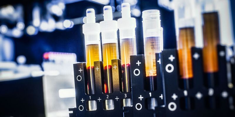 Blutproben im Labor (Symbolbild).(Bild:  DZNE/Haagman)