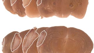 Gehirnschnitte von kontrollbehandelten (unten) und nasal Activin A-behandelten (oben) Mäusen nach einem Schlaganfall. Die weiße Linie markiert die Grenze zwischen den gesunden und geschädigten Gehirnregionen. (Dr. Bettina Buchthal)