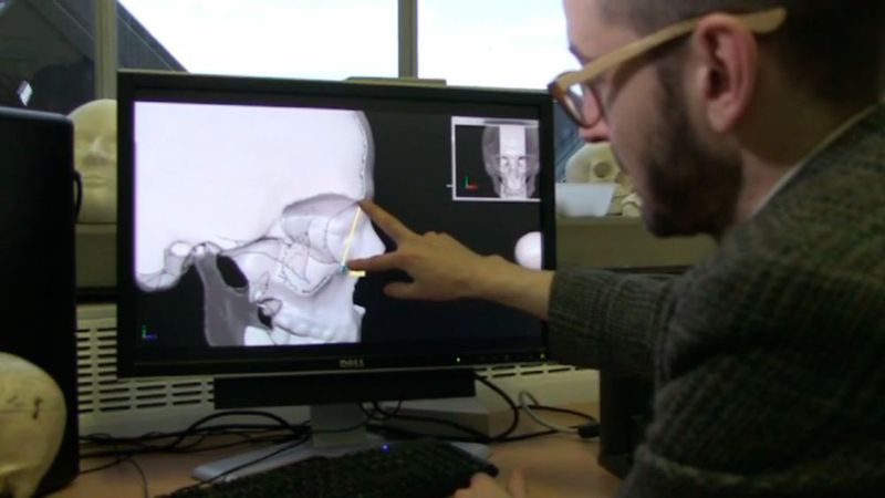 Dr. Christopher Rynn führt die Zuschauer in der BBC-Sendung „Inside Out“ durch den Ablauf einer Gesichtsrekonstruktion. (Artec 3D/BBC)