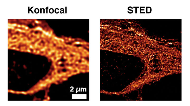 Abb. 2: Vergleich von klassischer Mikroskopie (konfokal) und STED-Mikroskopie (Bild: Leibniz-Institut für Ostseeforschung/Universitätsmedizin Göttingen)