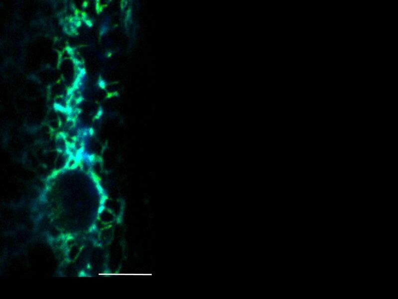 Abgebildet ist eine einzelne Muskelzelle des Fadenwurms, die den Fluoreszenzsensor Redox-GFP im Endoplasmatischen Retikulum synthetisiert. Der Sensor wird mit zwei verschiedenen Wellenlängen angeregt. Grüne Bereiche signalisieren reduzierende Bedingungen und blaue Bereiche oxidierte Zustände. Maßstabsleiste entspricht 10 µm. (Bild: Janine Kirstein)